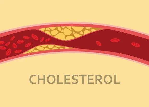 Czym jest cholesterol? Rola, rodzaje i skutki dla zdrowia – wszystko, co musisz wiedzieć Czym jest cholesterol? Rola, rodzaje i skutki dla zdrowia – wszystko, co musisz wiedzieć