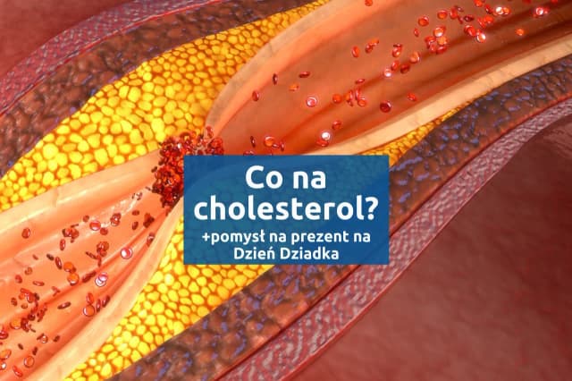 Czy stres podnosi cholesterol? Jak wpływa na zdrowie i jak go kontrolować Czy stres podnosi cholesterol? Jak wpływa na zdrowie i jak go kontrolować