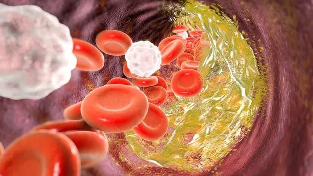 Czy cholesterol 250 to dużo? Normy, zagrożenia i jak go obniżyć Czy cholesterol 250 to dużo? Normy, zagrożenia i jak go obniżyć