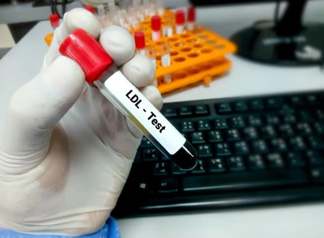 Jak bezpiecznie podnieść cholesterol? Sprawdź skuteczne metody i porady Jak bezpiecznie podnieść cholesterol? Sprawdź skuteczne metody i porady