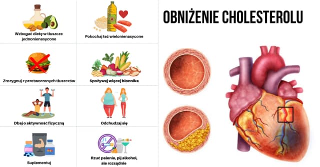 Jak skutecznie obniżyć cholesterol LDL i uniknąć problemów zdrowotnych Jak skutecznie obniżyć cholesterol LDL i uniknąć problemów zdrowotnych